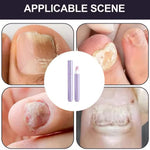 Load image into Gallery viewer, Cuticle Care Pen
