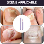 Load image into Gallery viewer, Cuticle Care Pen
