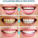 Load image into Gallery viewer, LumaPure™ — Un sourire éclatant et des gencives sans douleur au quotidien
